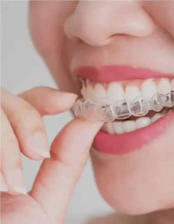 Am-I-a-candidate for-Invisalign