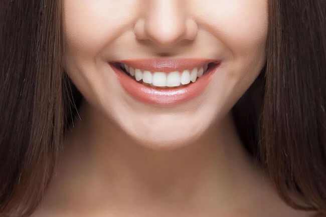 Dental-Bonding_Elevate-Dental